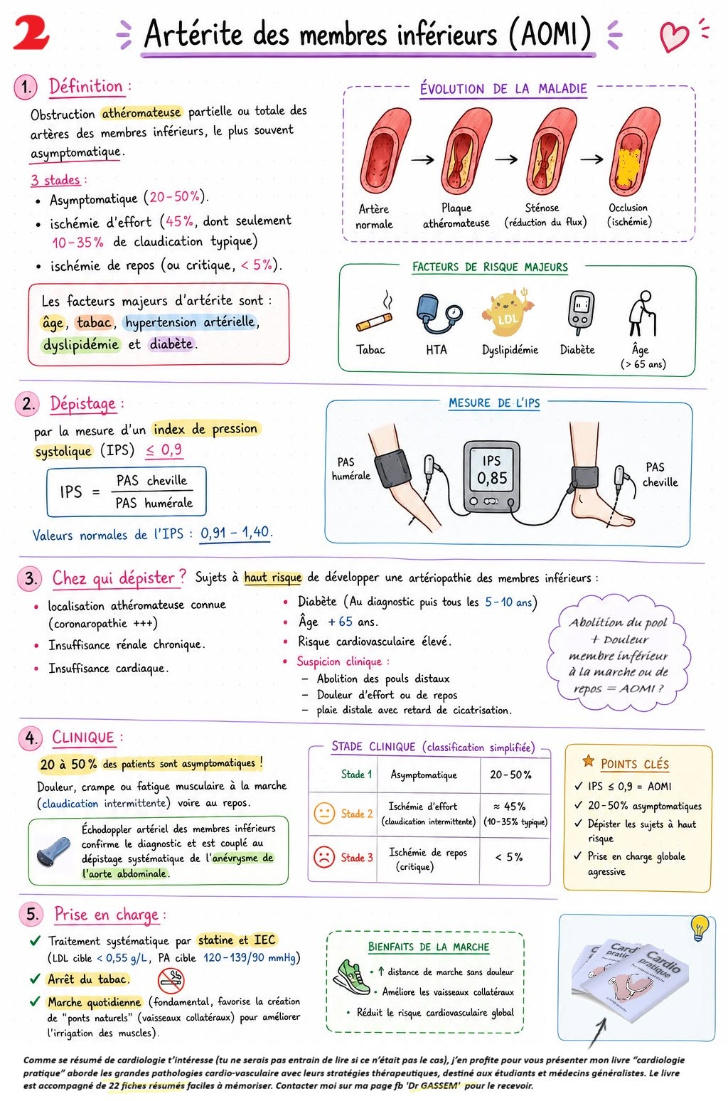 Artérite des membres inférieurs